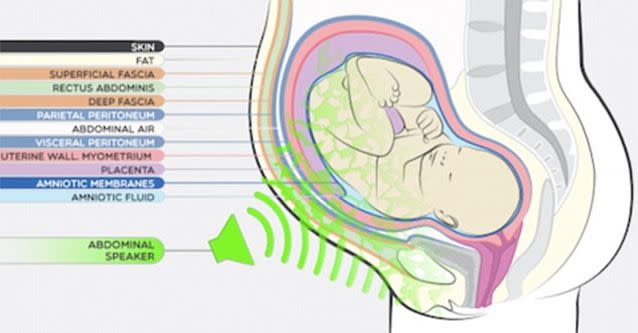 Music played outside the abdomen does not incite the same reaction as when transmitted from inside. Photo: Institut Marques