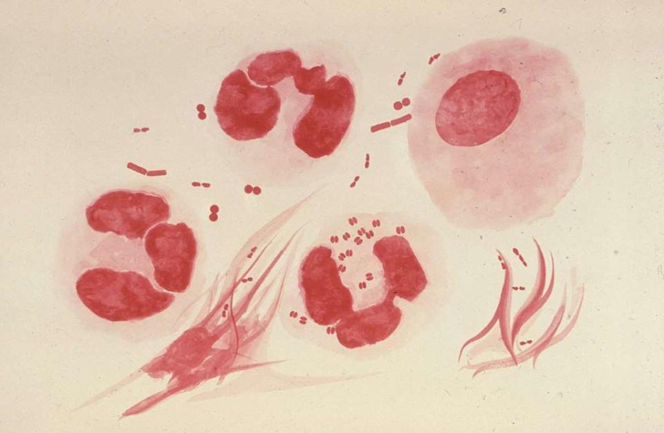 Des Neisseria gonorrhoeae infectant des neutrophiles (en bas au centre). On distingue bien leur forme particuli&#xe8;re dite en &#xab; grain de caf&#xe9; &#xbb;. &#xa9; CDC, Dr. Norman Jacobs