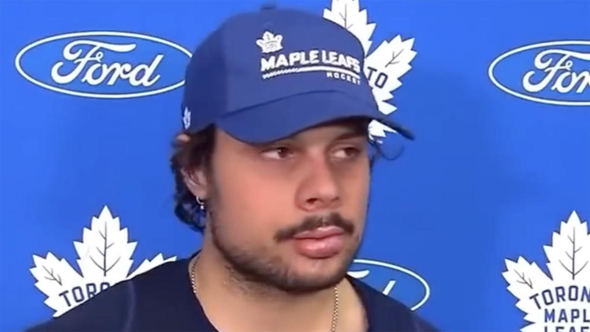 TSN on X: Auston Matthews met with the media for the first time since his  collision with the crossbar, which resulted in multiple hours at the  dentist and one lost tooth.  /