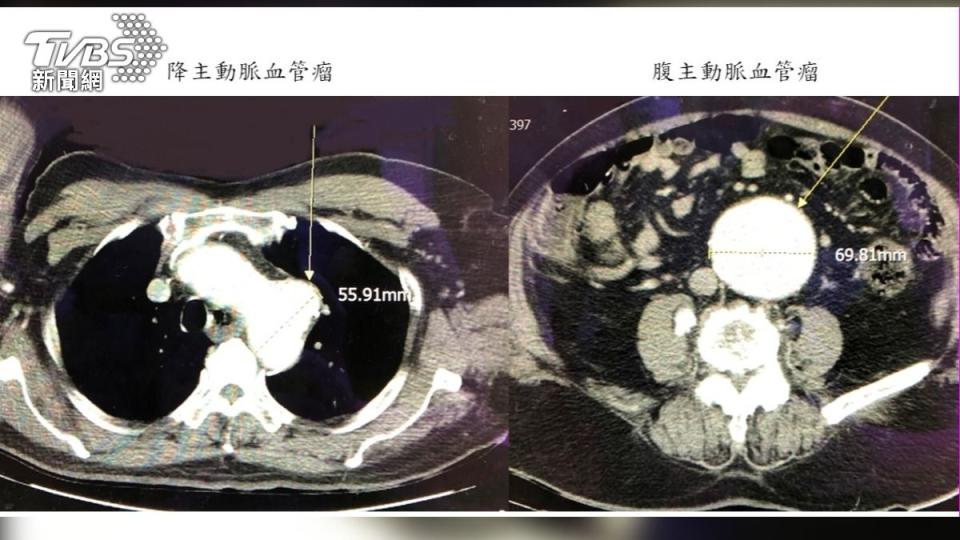 大千醫院提供