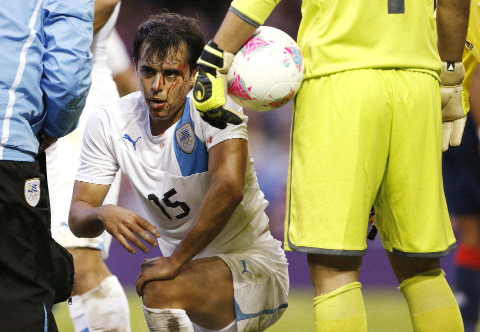 L'Uruguayen Diego Rodriguez en sang après un choc avec un footballeur britannique.