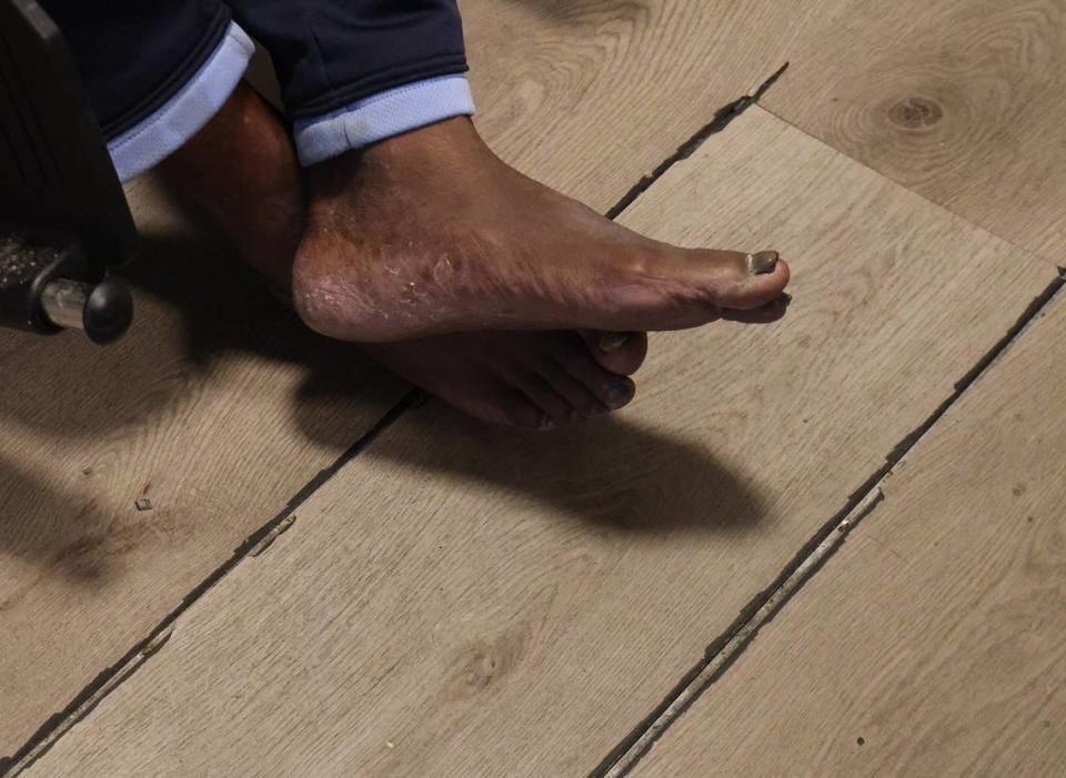 An elderly resident (who did not want to identified) sits in his wheelchair and explains how he struggles with the warped flooring inside his apartment in Liberty Square. The resident says Related Urban recently came in to fix the issue, but that he had been complaining about it for two years prior. 