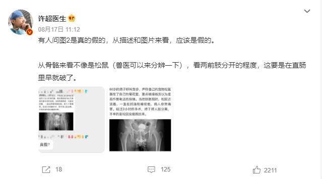 中國網紅醫師許超就直言，「看了描述和照片，就覺得應該是假的」。（翻攝自微博）
