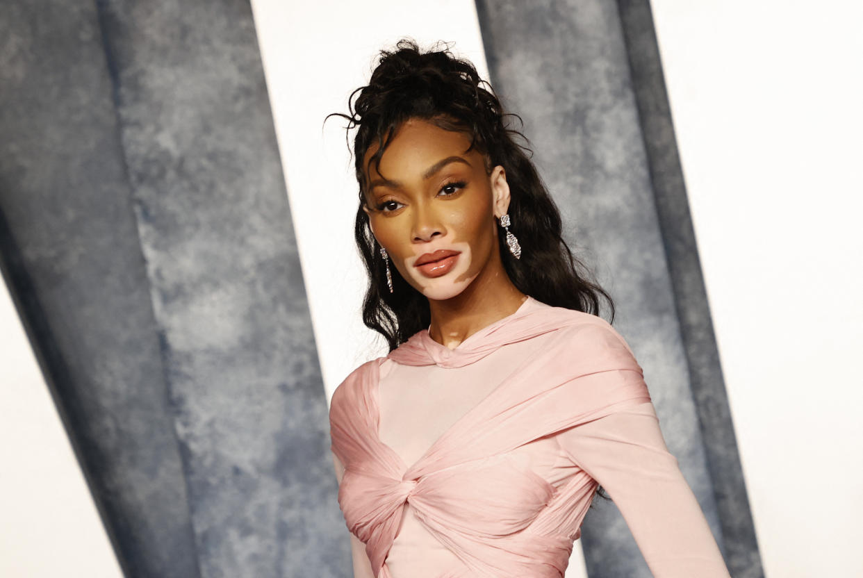 Winnie Harlow is showing appreciation for her roots, as she brings Cay Skin to Canada. (Photo by Michael Tran/AFP via Getty Images)