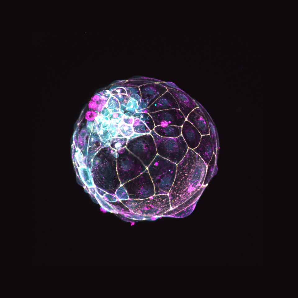 This image, provided by the Institute of Molecular Biology of the Austrian Academy of Sciences, shows a human “blastoid” created in a lab. A new study in Nature on Thursday, Dec. 2, 2021, shows how scientists created this structure that mimics a blastocyst, a ball of cells that form within a week of fertilization, and can be used in research. (Photo by Alok Javali, Heidar Heidari and Theresa Sommer/Institute of Molecular Biology of the Austrian Academy of Sciences via AP)