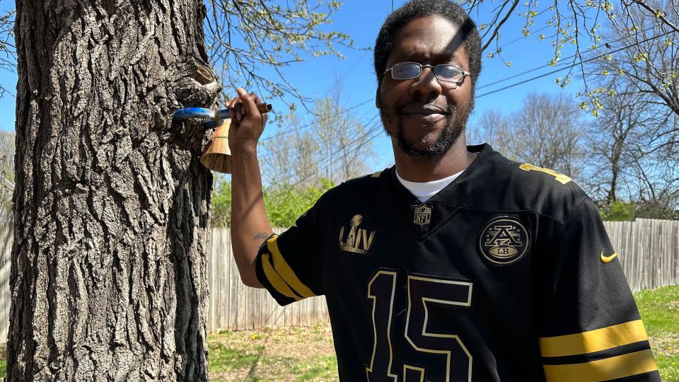 After being shot in the leg at the Kansas City Chiefs Super Bowl parade, James Lemons was initially told the bullet would stay there, unless it became a problem. “I get it, but I don't like that,” Lemons says. “Why wouldn’t you take it out if you could?” - Bram Sable-Smith/KFF Health News