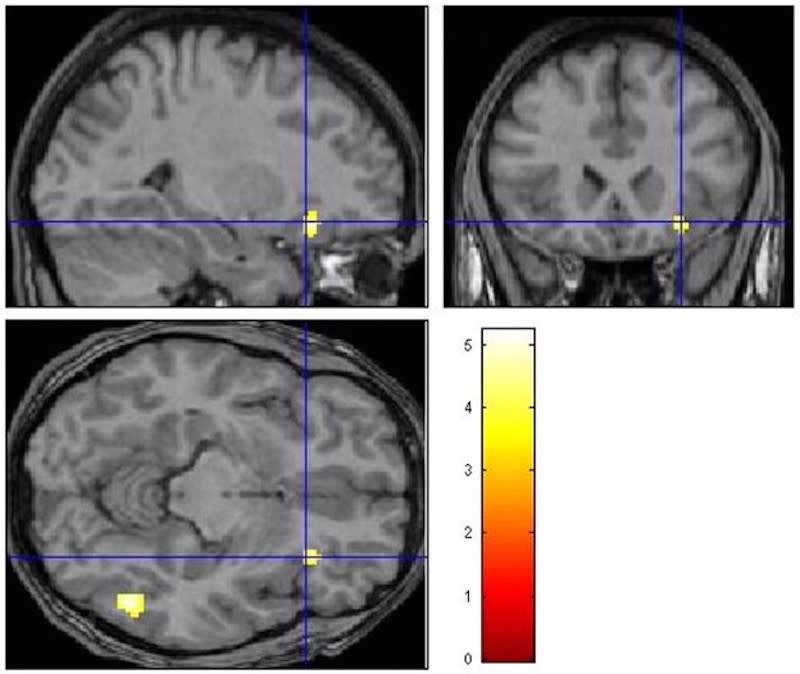 machiavellian brain