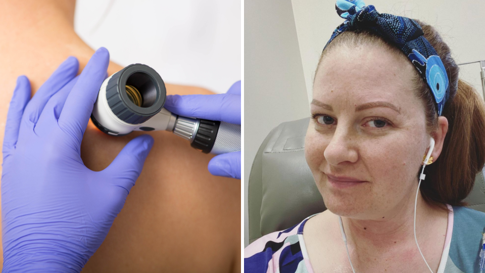 Close image of specialist checking back for skin cancer, Jane Elliott smiles at camera while wearing colourful headband. 