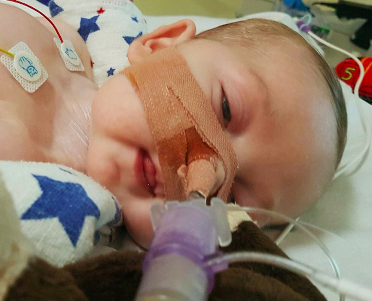 The 11-month old is suffering from brain damage as the result of a rare condition (PA)