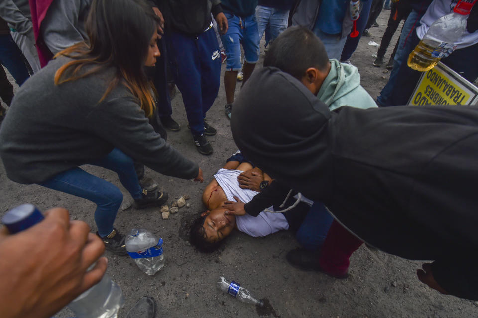 People aid a man injured during anti-government protests in Arequipa, Peru, Thursday, Jan. 19, 2023. Protesters are seeking immediate elections, President Dina Boluarte's resignation, the release of ousted President Pedro Castillo and justice for demonstrators killed in clashes with police. (AP Photo/Jose Sotomayor)