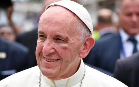 Pope Francis shows a bruise around his left eye  - Credit: REUTERS