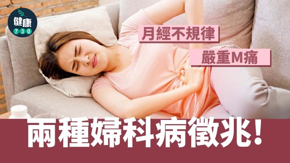 月經不規律、嚴重M痛 兩種婦科病徵兆