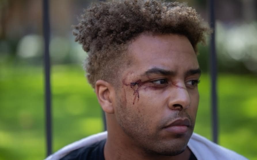 Nikko Lester says he was peacefully protesting with friends - Adam Gray for The Telegraph