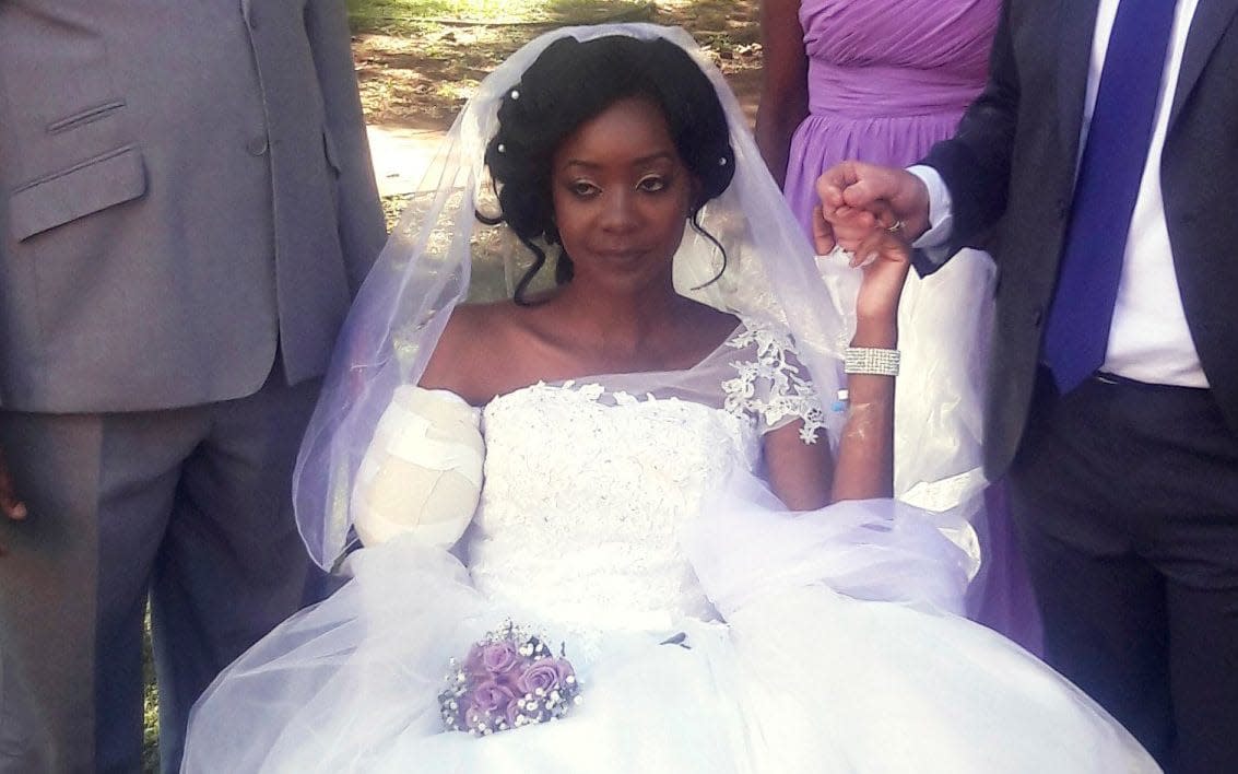 Zanele Ndlovu on her wedding day, just five days after a crocodile ripper her arm off - AP