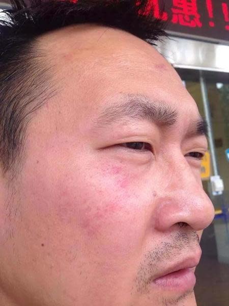 2015年夏天，王全璋在開庭時遭法警從法庭上拖出去、被毆打成傷。事後他立刻向公安報案，還沒對施暴的法警進行訴訟，便遭到抓捕。（翻攝自自網路）