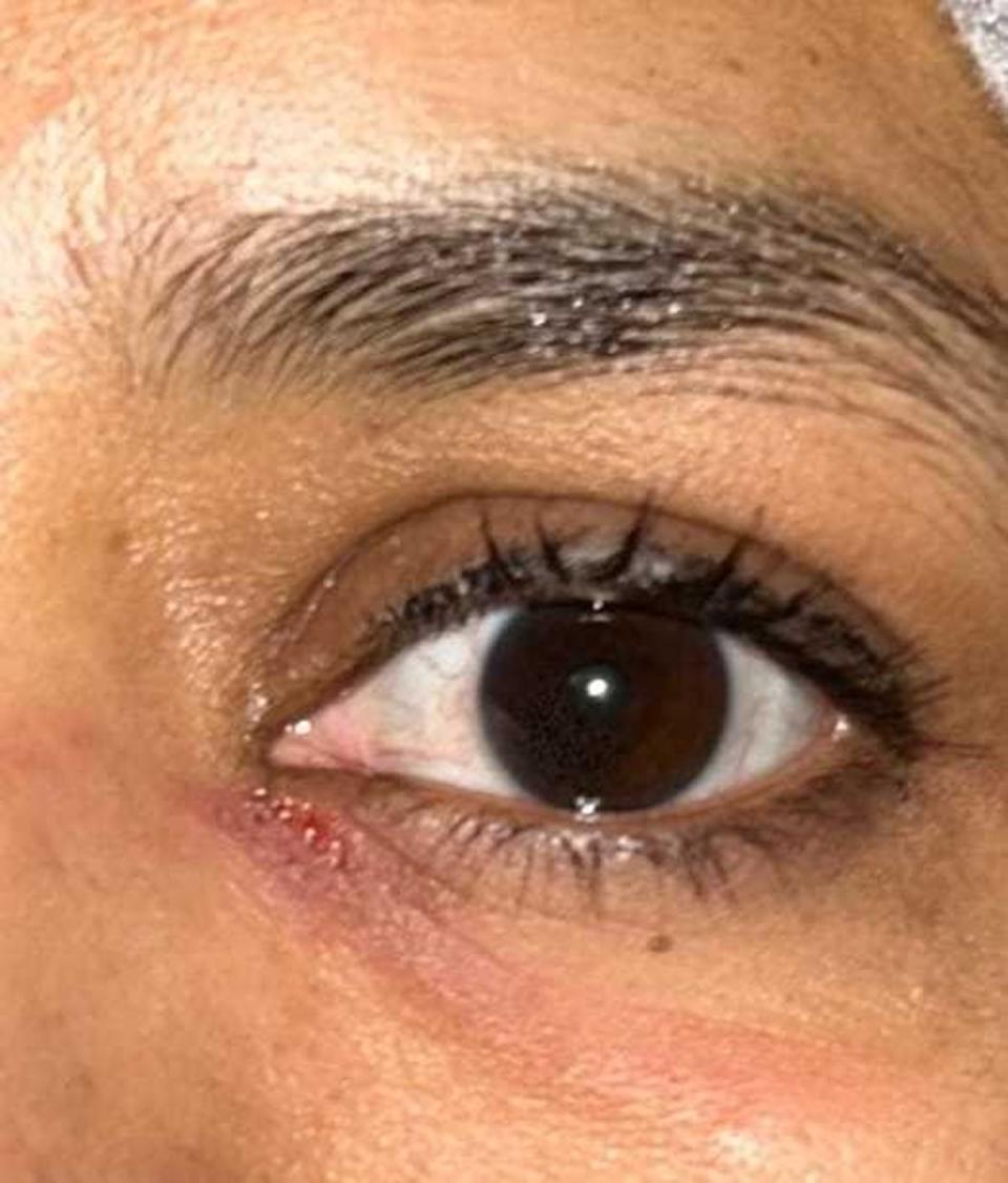 A Muslim woman was scratched under her eye in one incident (Shomrim)