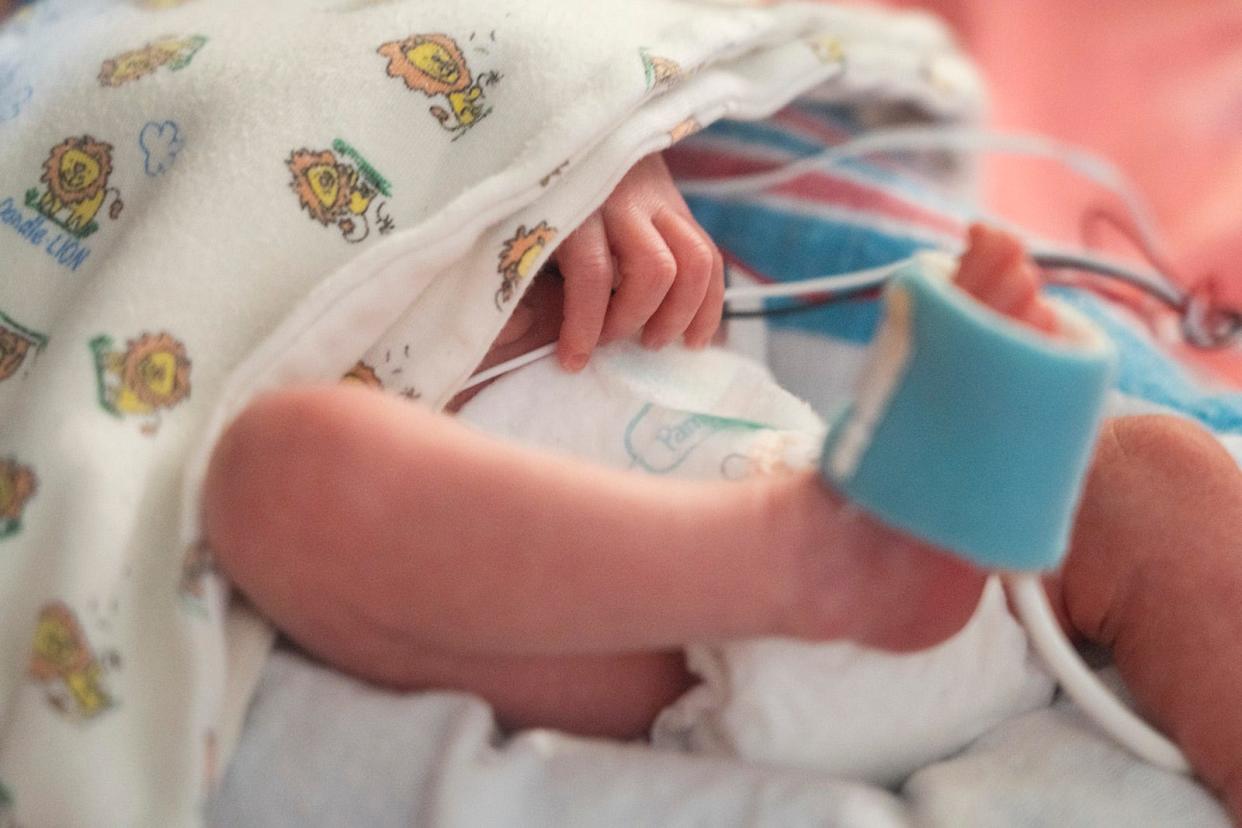A baby inside a neonatal intensive care unit. A live stream platform called Angel Eye offers parents a 24/7 remote access to the NICU at St. George Regional Hospital.
