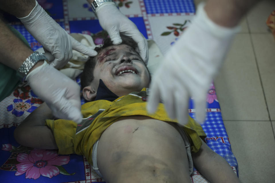Palestinian child wounded in Israeli bombardment is treated in a hospital in Deir al-Balah, south of the Gaza Strip, Tuesday, Oct. 17, 2023. (AP Photo/Hatem Moussa)
