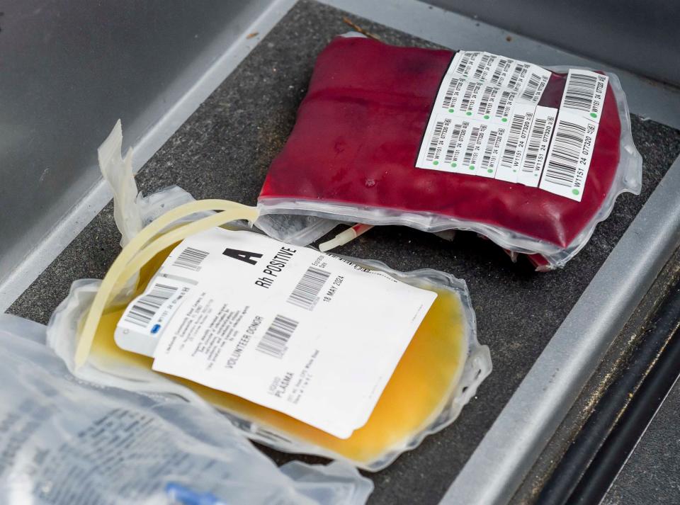 May 9 2024; Tuscaloosa, AL, USA; Tuscaloosa Fire and Rescue Service is now carrying blood and plasma for use with patients who have suffered traumatic injuries resulting in heavy blood loss.