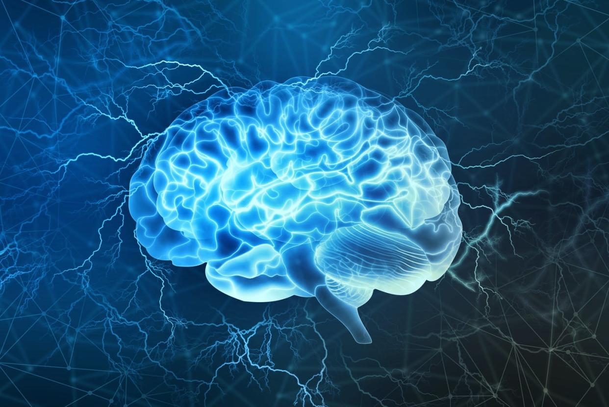 <span class="caption">What makes a brain tick is very different from how computers operate.</span> <span class="attribution"><a class="link " href="https://www.shutterstock.com/image-illustration/human-brain-digital-illustration-electrical-activity-719796733" rel="nofollow noopener" target="_blank" data-ylk="slk:Yurchanka Siarhei/Shutterstock.com;elm:context_link;itc:0;sec:content-canvas">Yurchanka Siarhei/Shutterstock.com</a></span>