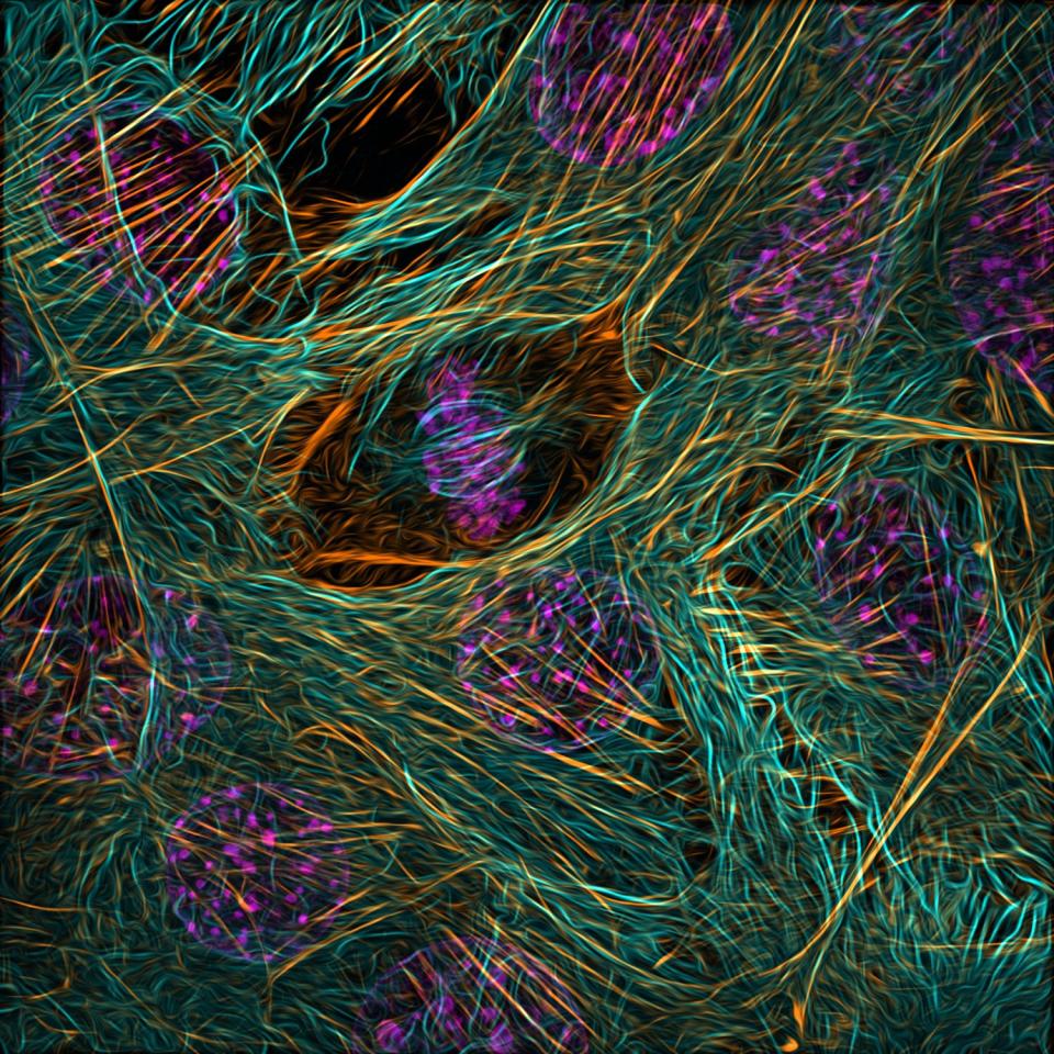 <strong>9th place.</strong> Cytoskeleton of a dividing myoblast highlighting the cellular components tubulin (cyan), F-actin (orange) and nucleus (magenta), magnified 63x.