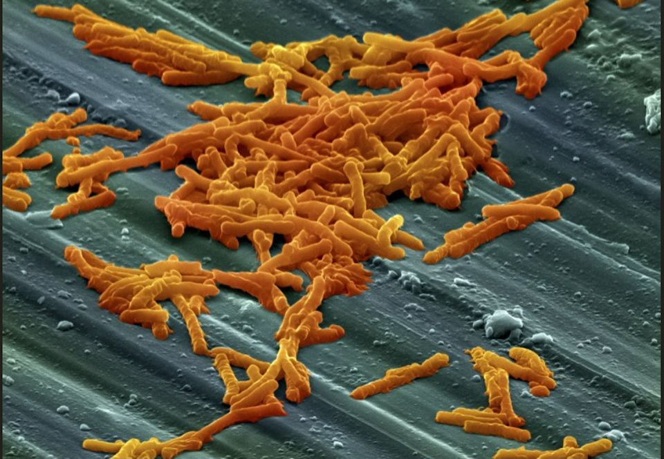 Colonia de la bacteria ‘Clostridium’. Se ha comprobado que las personas afectadas por estreñimiento crónico tienen esta bacteria en cantidades más elevadas. <a href="https://www.flickr.com/photos/frecuenciamedicafb/6866129626" rel="nofollow noopener" target="_blank" data-ylk="slk:Francisco Bengoa / Flickr;elm:context_link;itc:0;sec:content-canvas" class="link ">Francisco Bengoa / Flickr</a>, <a href="http://creativecommons.org/licenses/by/4.0/" rel="nofollow noopener" target="_blank" data-ylk="slk:CC BY;elm:context_link;itc:0;sec:content-canvas" class="link ">CC BY</a>