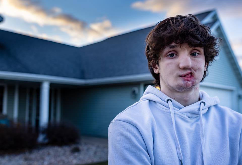 Carson Molle, 18, who survived a suicide attempt in 2017, has received thousands of responses from children and teens since he began sharing his experience on social media a couple of years ago. The young man, standing outside his family's home in Wisconsin, says helping others has aided his healing.