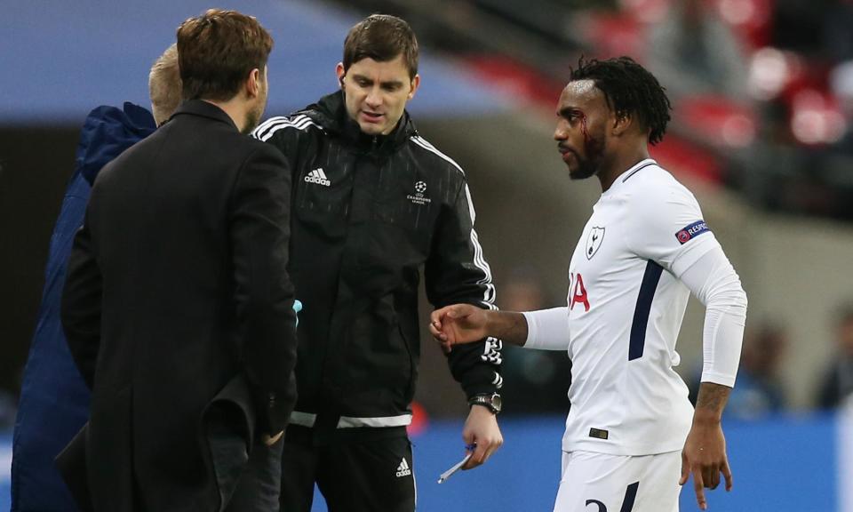 Mauricio Pochettino, hands in pockets, looks on as Danny Rose comes off against Apoel Nicosia with a cut head