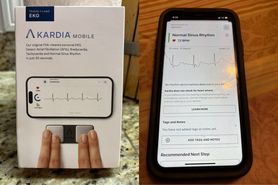 An expert calls this portable ECG monitor a 