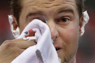 FILE - In this July 4, 2011, file photo, St. Louis Cardinals' Mark Hamilton wipes his face after being hit with a shaving cream pie from teammate Colby Rasmus following the Cardinals' 1-0 victory over the Cincinnati Reds in a baseball game in St. Louis. On Friday, April 10, 2020, under an accelerated schedule prompted by dire circumstances, the former big leaguer is set to graduate a month early from medical school on Long Island. Next stop for the rookie doc, most likely, the first-hand fight against the coronavirus pandemic. (AP Photo/Jeff Roberson, File)