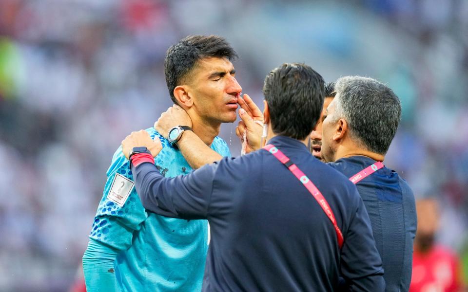 Goalkeeper Alireza Beiranvand of Iran is being treated during the FIFA World Cup Qatar 2022 Group B match between England and IR Iran at Khalifa International Stadium - Iranian goalkeeper tries to play on after suffering sickening head clash - Getty Images/Ulrik Pedersen