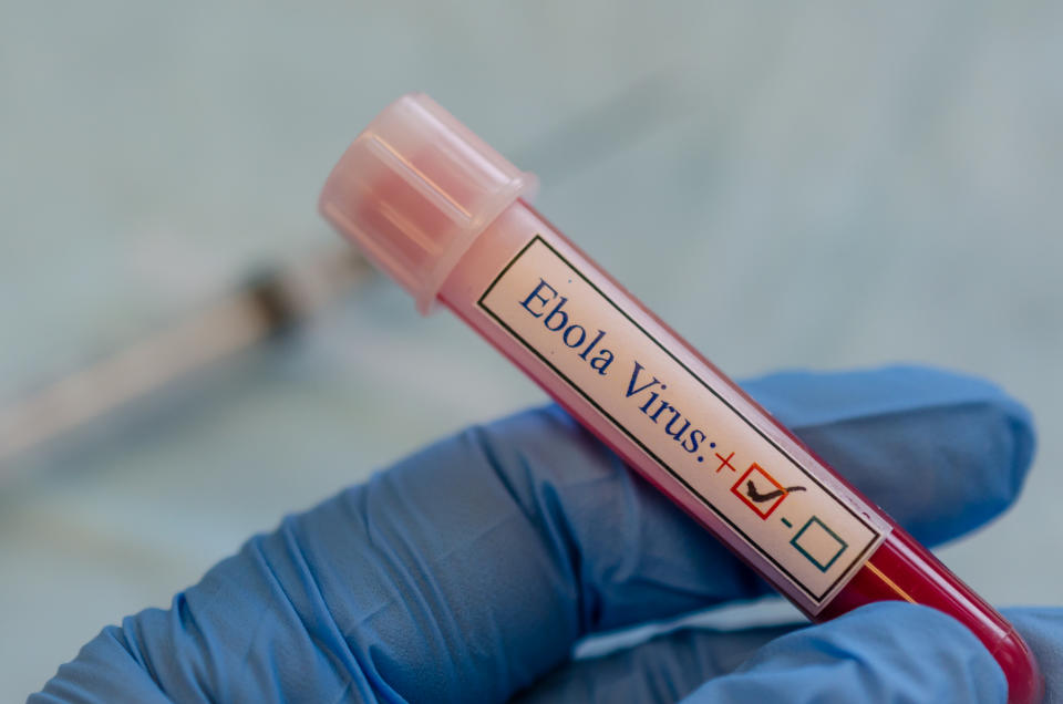 A fictional ebola virus positive blood sample