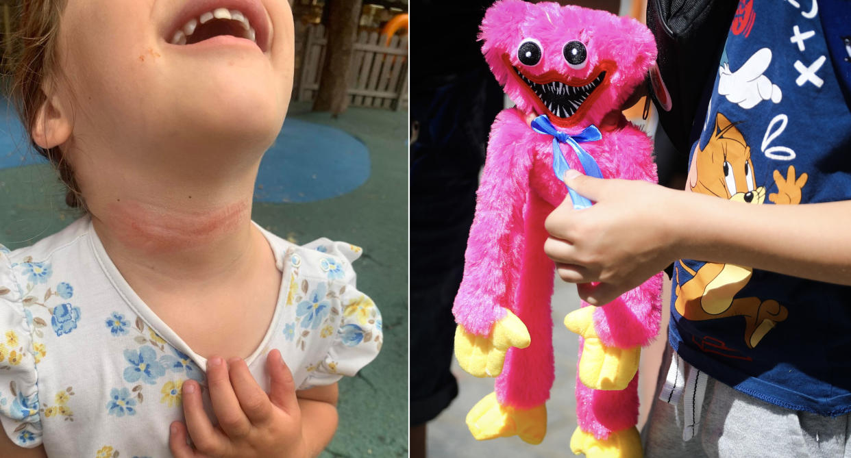 A three-year-old girl was left with marks around her neck following a playground attack.