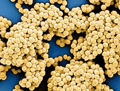 Microscopic view of methicillin-resistant Staphylococcus aureus (MRSA) bacteria. (NIAID), <a href="http://creativecommons.org/licenses/by/4.0/" rel="nofollow noopener" target="_blank" data-ylk="slk:CC BY;elm:context_link;itc:0;sec:content-canvas" class="link ">CC BY</a>