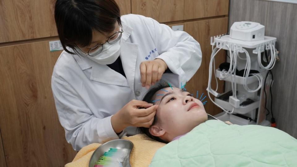 秀傳醫師郭惠雯說，透過針灸改善顏面神經，不僅可改善頭風等症狀，也可達到養顏美容效果。（記者曾厚銘攝）