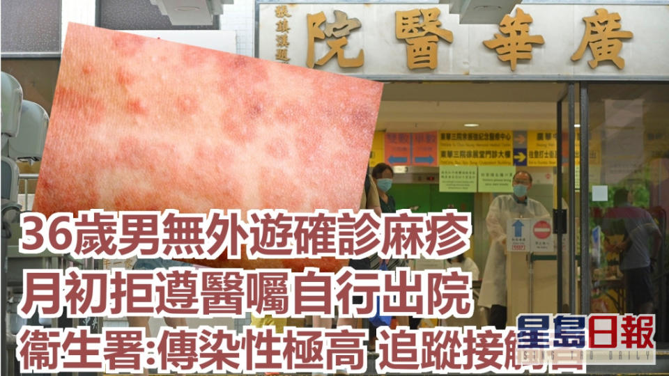 衞生署發言人說，麻疹由麻疹病毒引起，傳染性極高。資料圖片