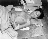 FILE - In this late 1945, file photo, released by Corps of Engineers, a young man, a victim of the second atomic bomb ever used in warfare lies sick on a mat in Nagasaki, Japan. The city of Nagasaki in southern Japan marks the 75th anniversary of the U.S. atomic bombing of Aug. 9, 1945. Japan surrendered on Aug. 15, ending World War II and its nearly a half-century aggression toward Asian neighbors. Dwindling survivors, whose average age exceeds 83, increasingly worry about passing their lessons on to younger generations. (Corps of Engineers via AP, File)