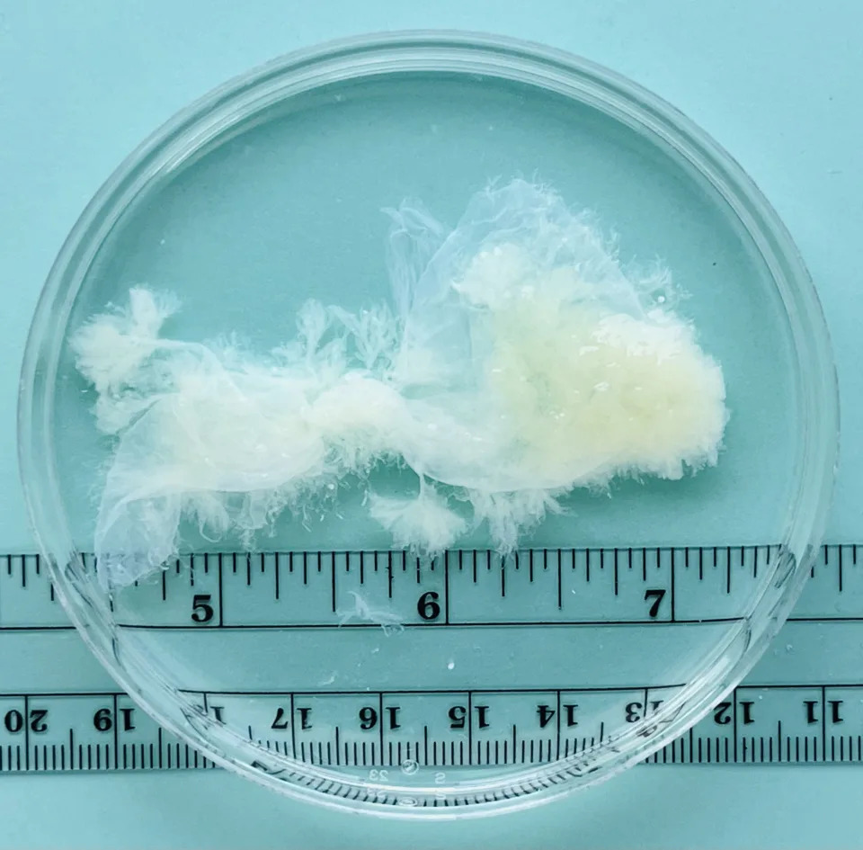 White and yellowish clusters of tissue in a petri dish.