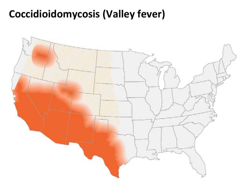 This map shows CDC's current estimate of where the fungi that cause Valley fever live in the environment in the United States. The disease is also common in northern Mexico. / Credit: Centers for Disease Control and Prevention