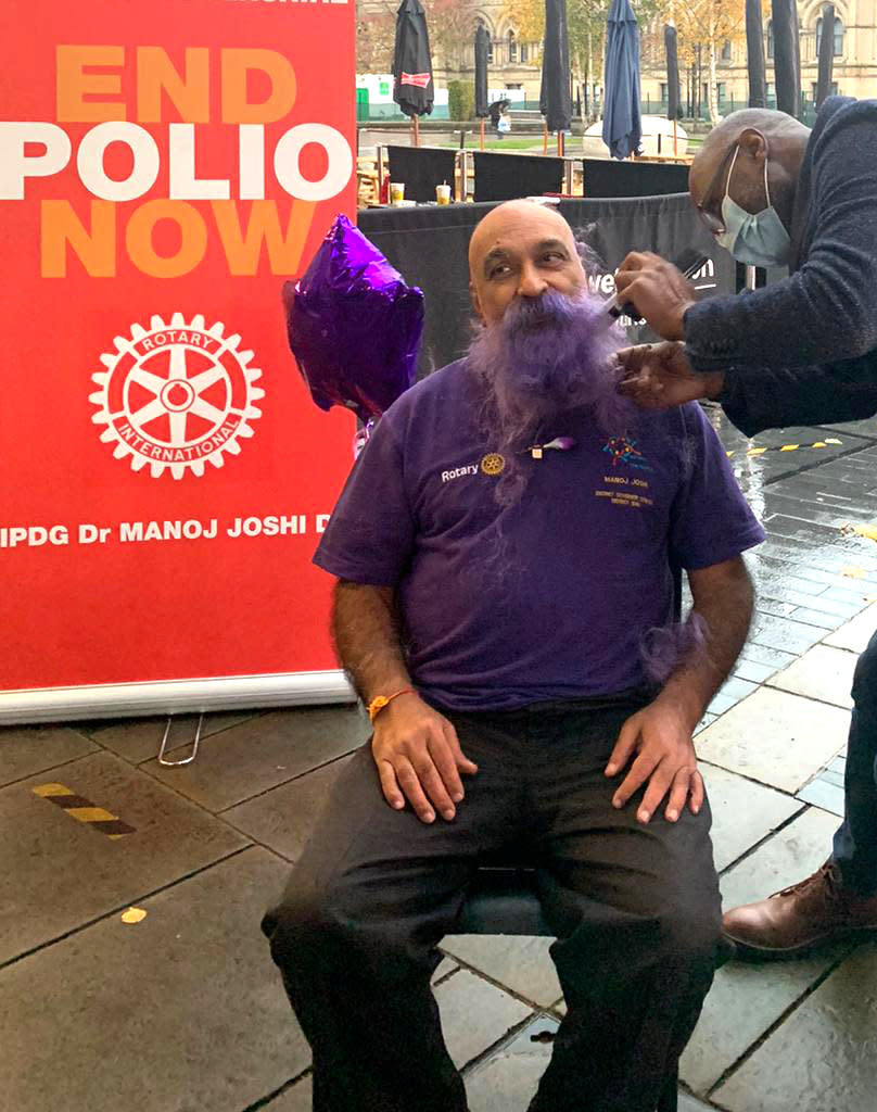 Dr Manoj Joshi, 68, shaved his moustache for the first time in 52 YEARS at Bradford City Hall to raise funds to eradicate polio. See SWNS story SWLEmoustache; A man who shaved his moustache to raise funds for a polio vaccine says his wife cant even recognise him - after he trimmed it for the first time in 52 YEARS. Dr Manoj Joshi, 68, says he had never shaved his moustache ever since he could grow one as a fresh faced 16-year-old but decided to chop it all off in a bid to eradicate polio. But after he chopped it off his shocked wife said she couldnt recognise him as shed never seen him without it in the 42 years they had been married. The grandfather-of-two joked that it would take a lawn mower to trim his luscious facial hair - which is older than the invention of the mobile phone. Dr Joshi, a proud Rotarian, which is a worldwide charitable society with over a million members worldwide, has been involved in what he calls acts of giving for his entire life. On World Polio Day (Saturday, Oct 24) he took centre stage at a park in front of Bradford City Hall to shave off his beloved moustache in an emotional day.