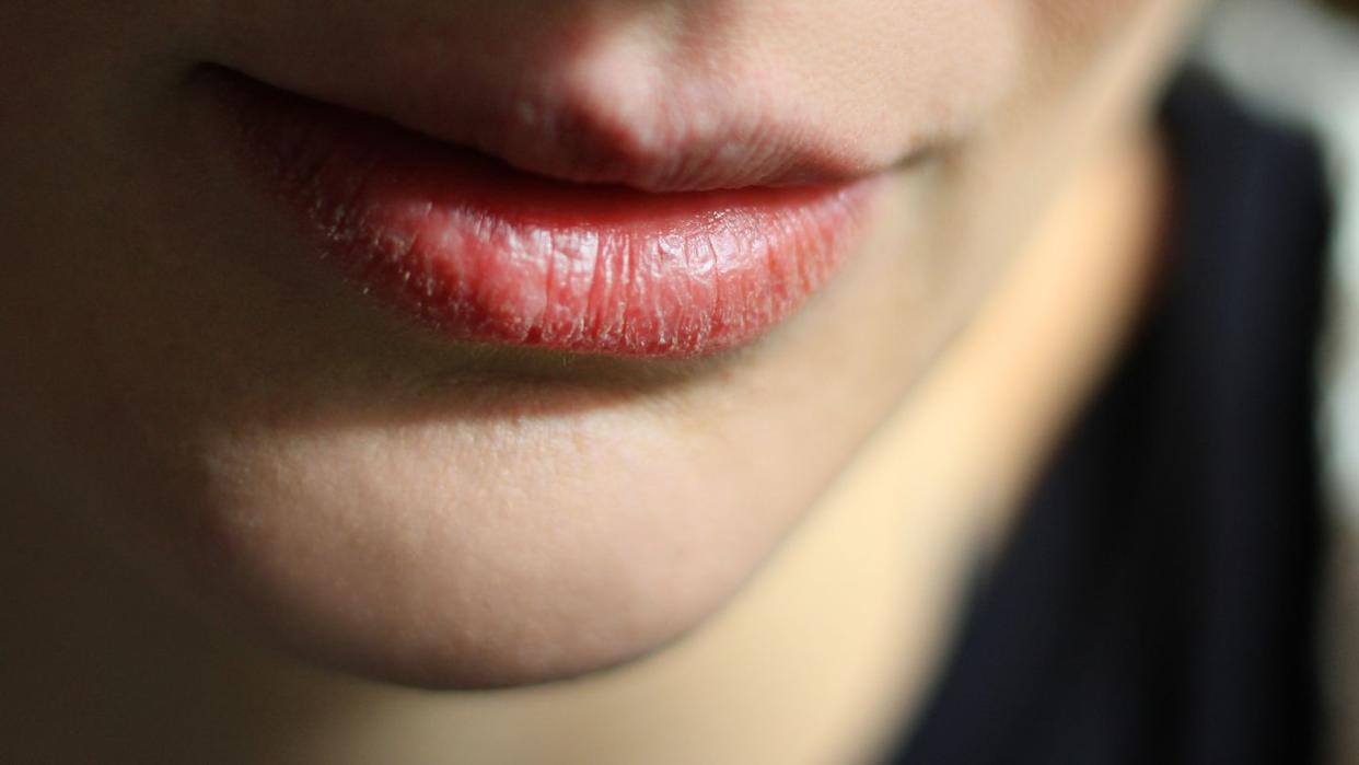 Close-Up Of Woman With Dry Lip At Home