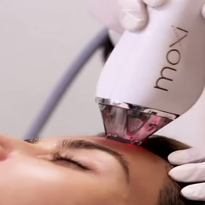 Close-up of Kim getting Moxi laser