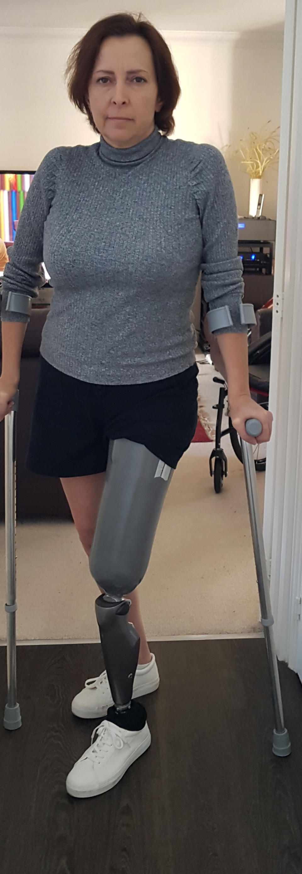 Helen Way, 49, received her prosthetic leg in Oct 2020. (Caters)