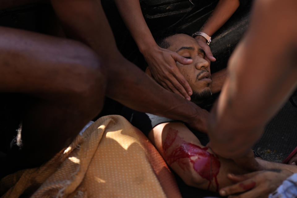 A resident comforts a wounded man as he is placed in the back of a truck after a police operation targeting a criminal group that resulted in multiple deaths, in the Complexo do Alemao favela in Rio de Janeiro, Brazil, on July 21, 2022. (AP Photo/Silvia Izquierdo)