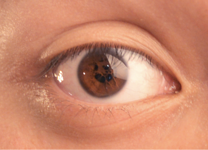 A close-up of a human eye looking slightly upward with a detailed iris