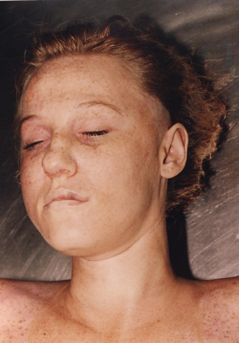 At the time of her death, Mercedes was wearing a white T-shirt, acid washed blue jeans, a black belt, white ankle socks, white tennis shoes, two silver bracelets on her right wrist and a gold ring on her right forefinger.<br /><br />According to Detective Cathy Phillips, Mercedes tested positive for cocaine in her system.<br /><br />"She had two injuries -- blunt trauma and the gunshot wound to her head," Phillips said. "The trauma was to her neck, but she died from the gunshot wound. It was to her temple."