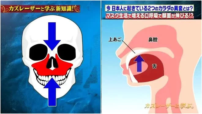 醫師表示呼吸方式也會改變臉型，對小朋友來說尤其明顯。引自日本節目カズレーザーと学ぶ。