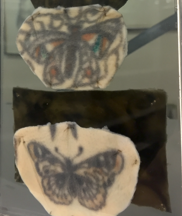 Muestras del Museo de Patología de la UCL: la piel tatuada de un artista de circo.