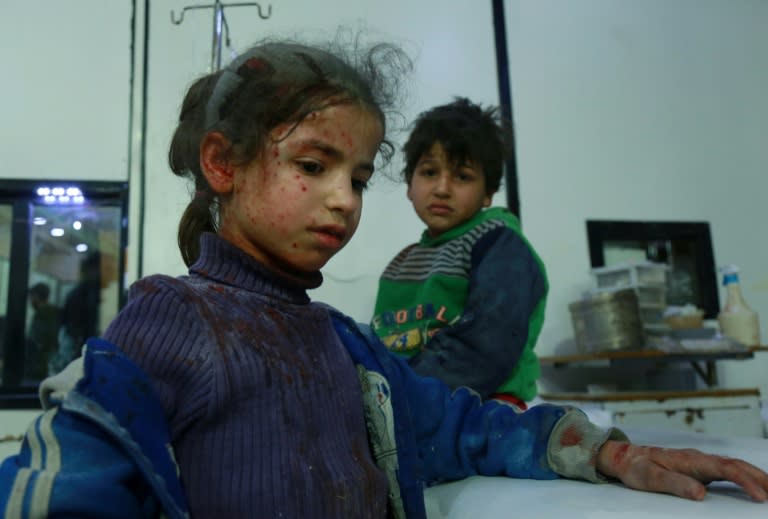 Wounded Syrian children await treatment at a makeshift hospital in the main Eastern Ghouta town of Douma after fresh air strikes on the rebel enclave on February 23, 2018