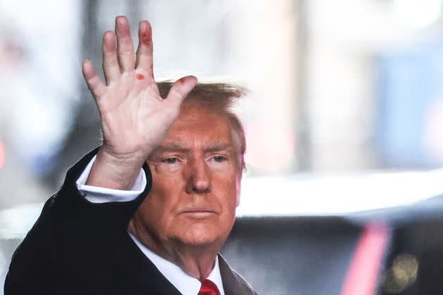 Donald Trump was seen leaving Trump Tower on Jan. 17 with red marks on his hand.